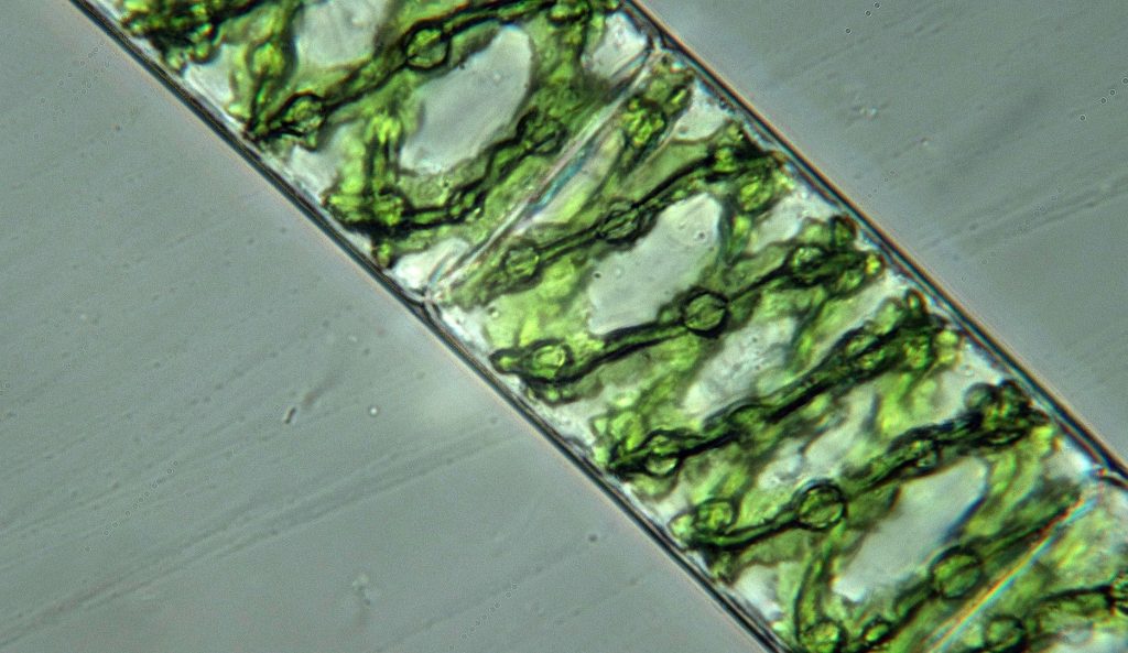 Spirogyra-1